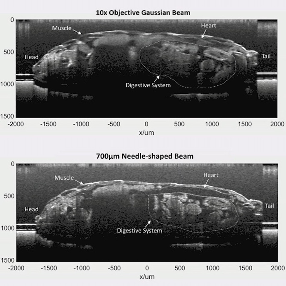 Needle point: beating heart Needle point: beating heart