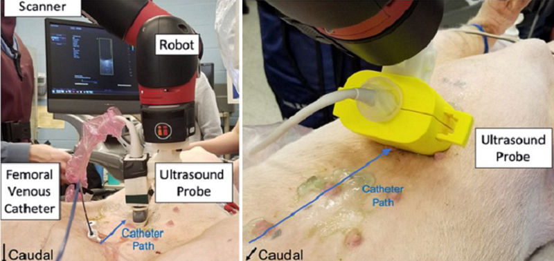 Photoacoustics helps guide cardiac catheters, boosting heart surgery safety. Click for info.