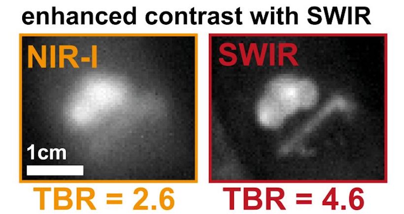 Clearer views: SWIR imaging of tumors