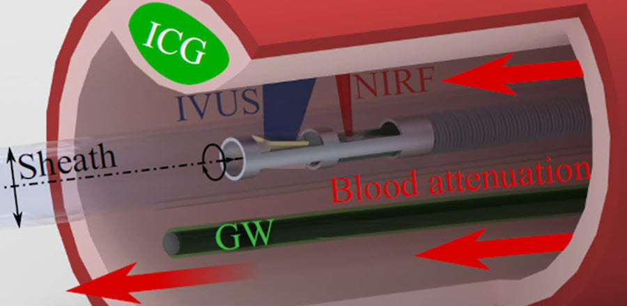 In full flow: imaging in blood vessels In full flow: imaging in blood vessels