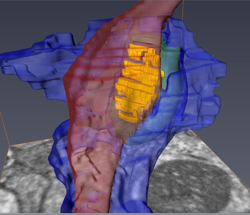 Identified and imaged: 3D synapses