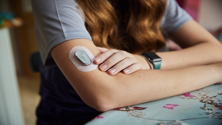 Continuous glucose monitoring