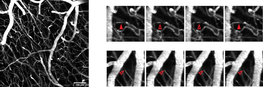 No stalling: faster more precise imaging