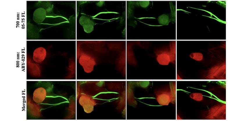 Visible difference: tissue types