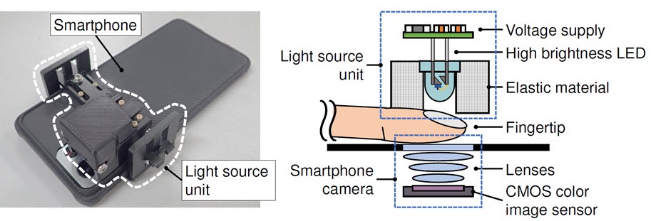In the blood: sugar levels In the blood: sugar levels