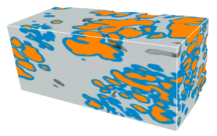 Microscopic glands of the prostate are segmented with the new deep-learning pipeline.