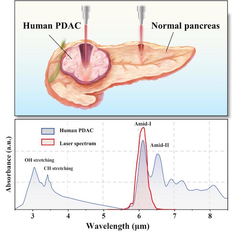 On the right wavelength: targeted treatment