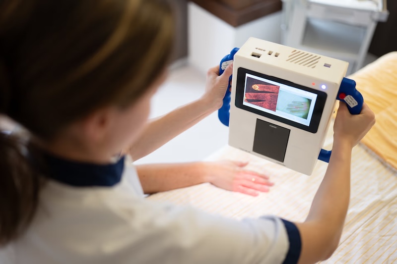 Laser speckle contrast: blood cells in motion