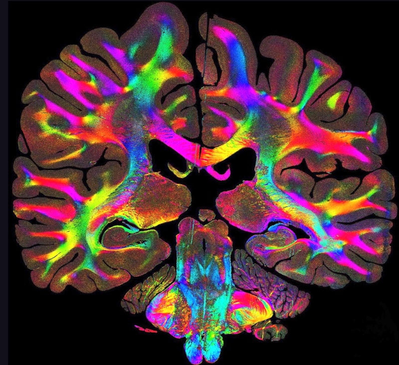 Network revealed by rotating LED light source and microscope camera