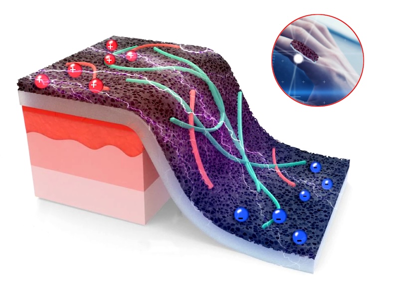 Wound care: graphene sensor Wound care: graphene sensor