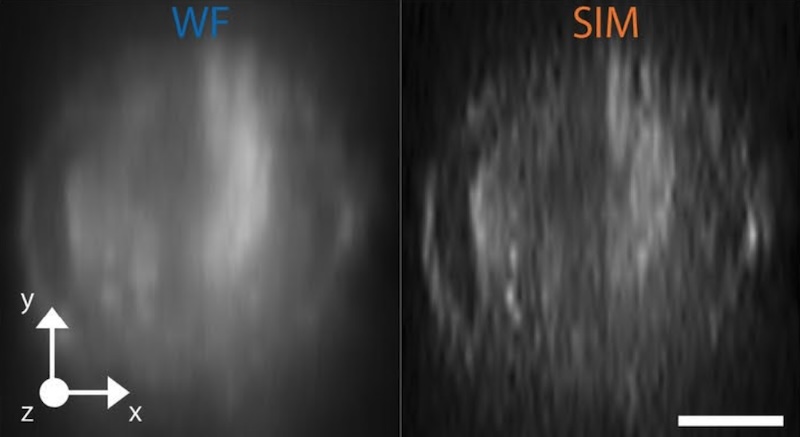 Cell analysis via imaging flow cytometry