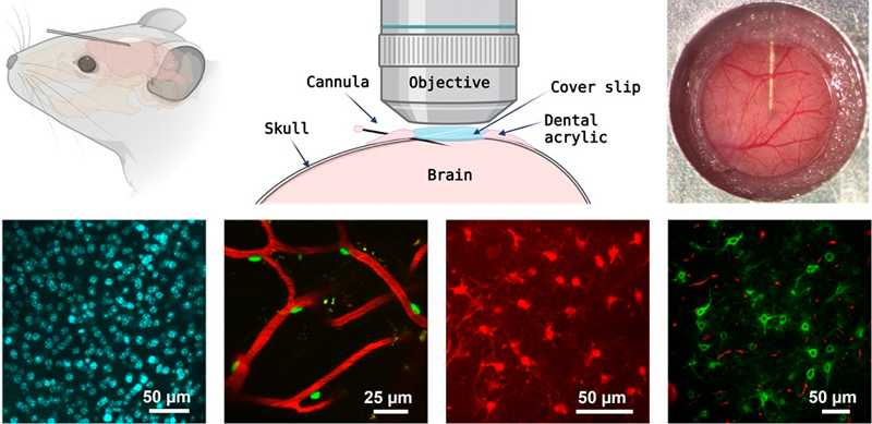 New cannula system delivers imaging agents directly to the brain.