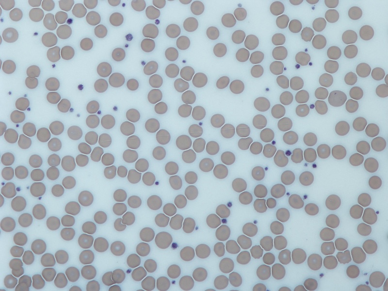 Platelets: new details of their behavior