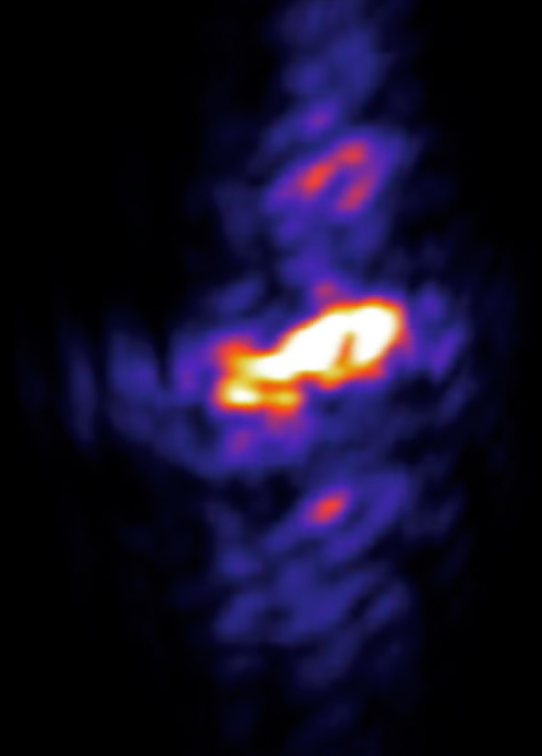 An x-ray flash in which Rabi cycling and filamentation were observed.