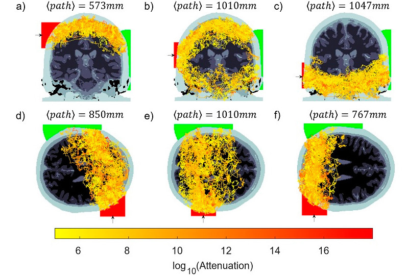 Detecting photons through an entire adult human head. Click for info.