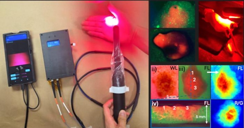 Oral health: cancer screening