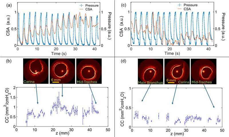 Accurate mapping of airway wall compliance along upper airway.