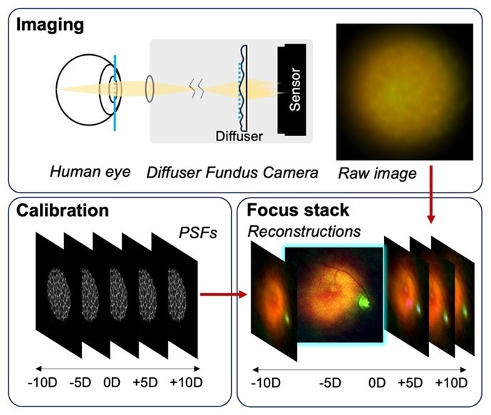 Imaging system uses special diffuser that captures 3D information from the retina. Imaging system uses special diffuser that captures 3D information from the retina.