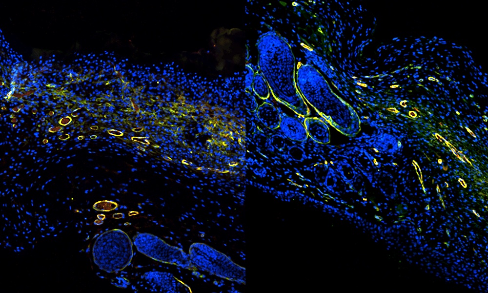 Rate of repair: hydrogel-treated wounds