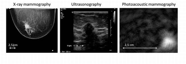 Photoacoustic scan Photoacoustic scan