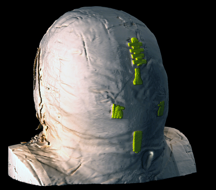 All wrapped up: The 2000-year old Rhind Mummy.