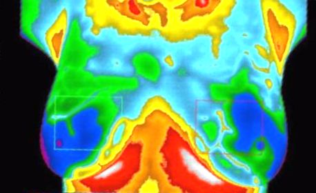 Infrared scanning for breast cancer: now worthy of wider adoption Infrared scanning for breast cancer: now worthy of wider adoption