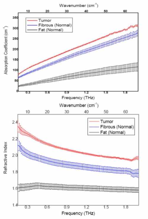THz spots the difference in breast cancer tissue