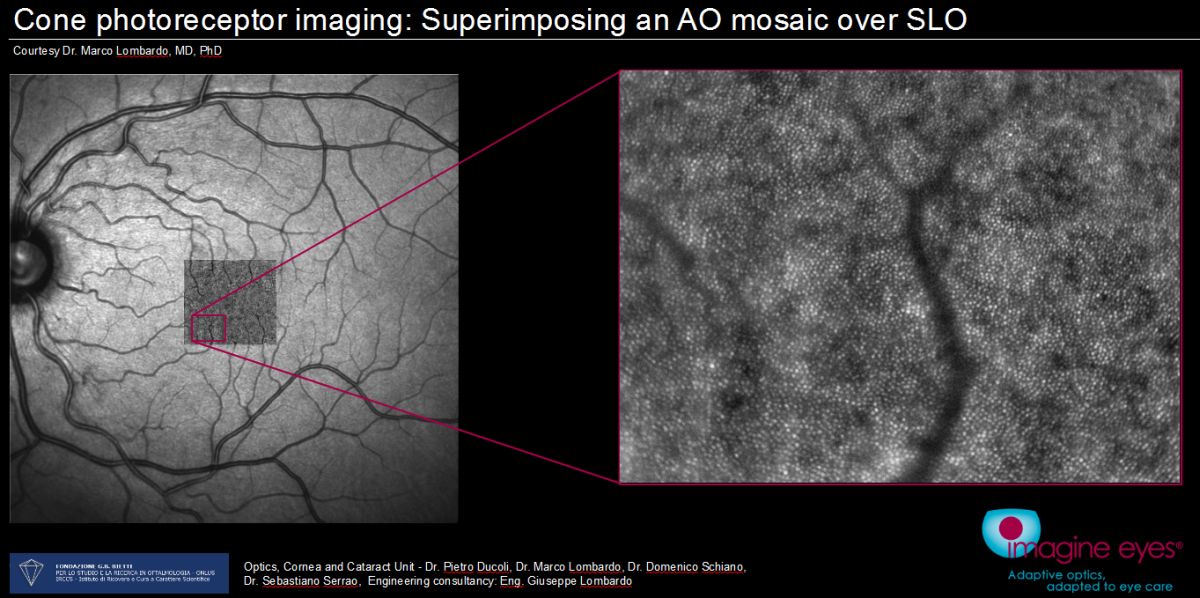 AO imaging