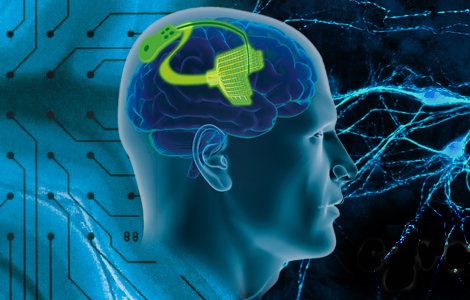 Brain wave: Laser enables radical experiments in neurobiology.