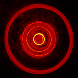 Well rounded: Poggendorff rings.