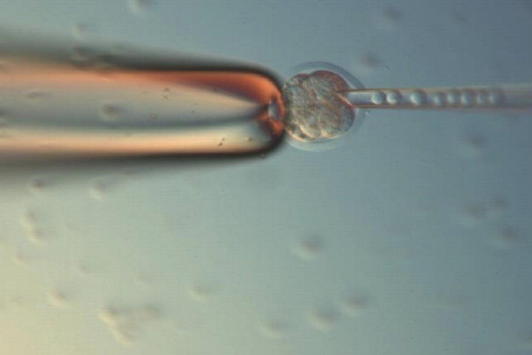 Stem cell injection Stem cell injection