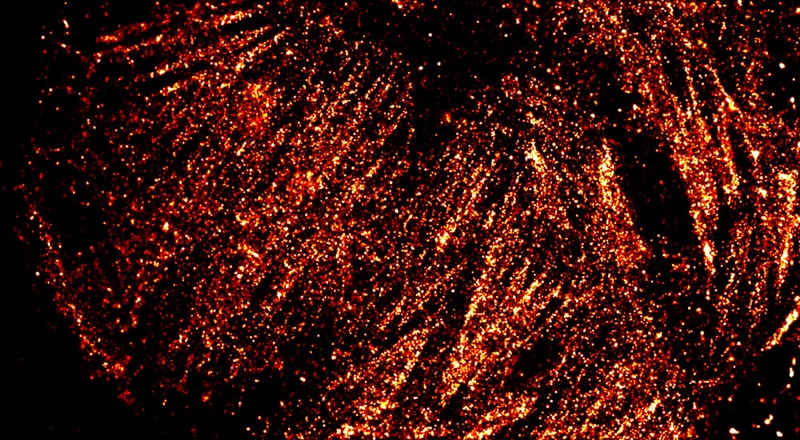 Super-resolved cytoskeleton Super-resolved cytoskeleton