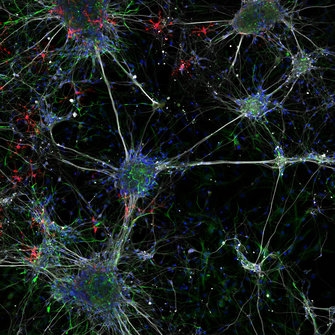 Extraordinary imaging Extraordinary imaging