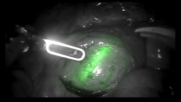 First do no harm: fluorescence shows the way