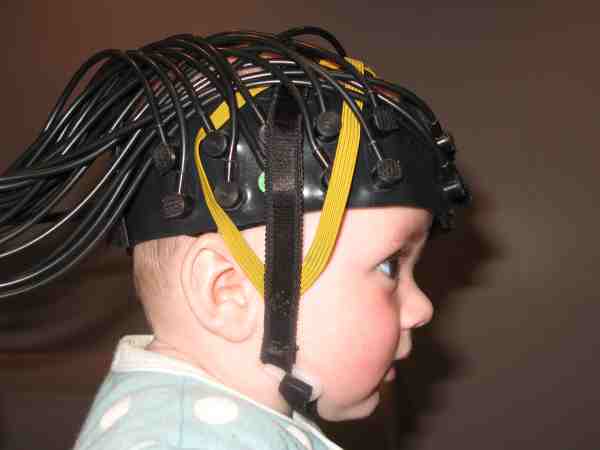 Measuring hemodynamics in young infants.