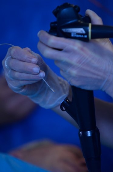 Cellvizio in action Cellvizio in action