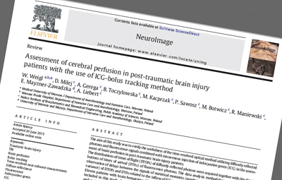 Published: NeuroImage journal.