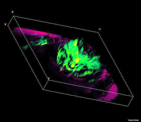 Ptychography in action