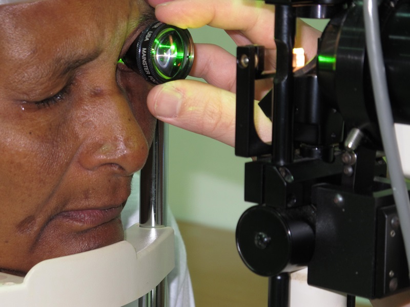 Laser photocoagulation