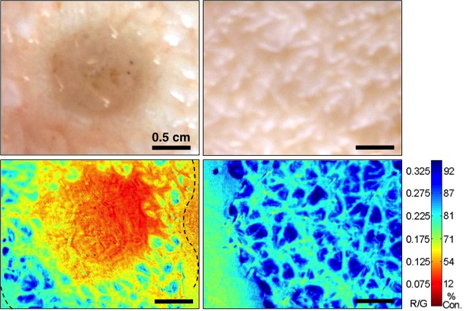 Under the skin: oxygen comsumption suffers