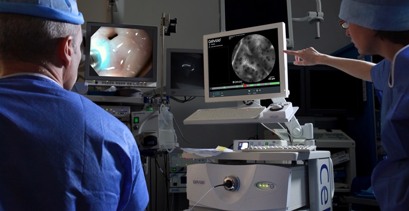 Surgeons using Cellvizio