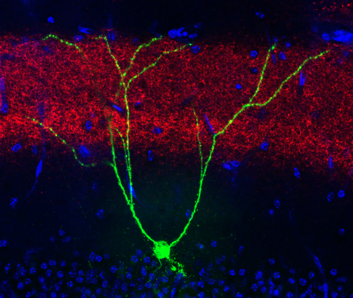 Engram cell in Engram cell in