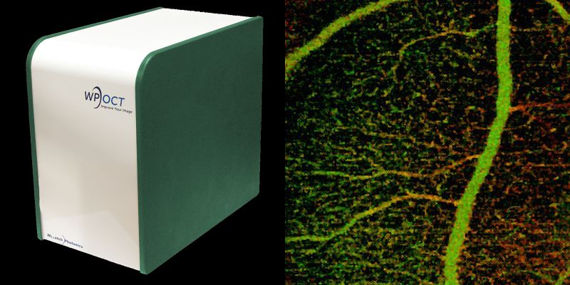OCT angiography: structural and blood flow information.