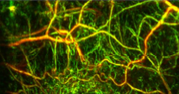 Blood flow: criticial in cancer studies