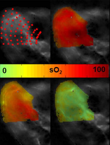 eMSOT: more accurate oxygenation data