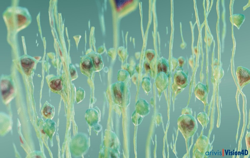 Light-sheet image of mouse brain tissue