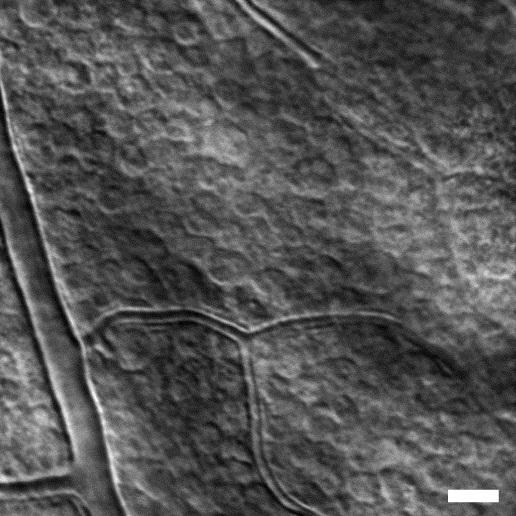 Retinal ganglion cell layer in a rhesus macaque monkey (scale bar is 25µm).