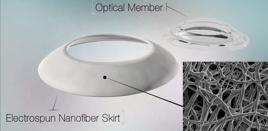 CorNeat Kpro: better biocompatibility