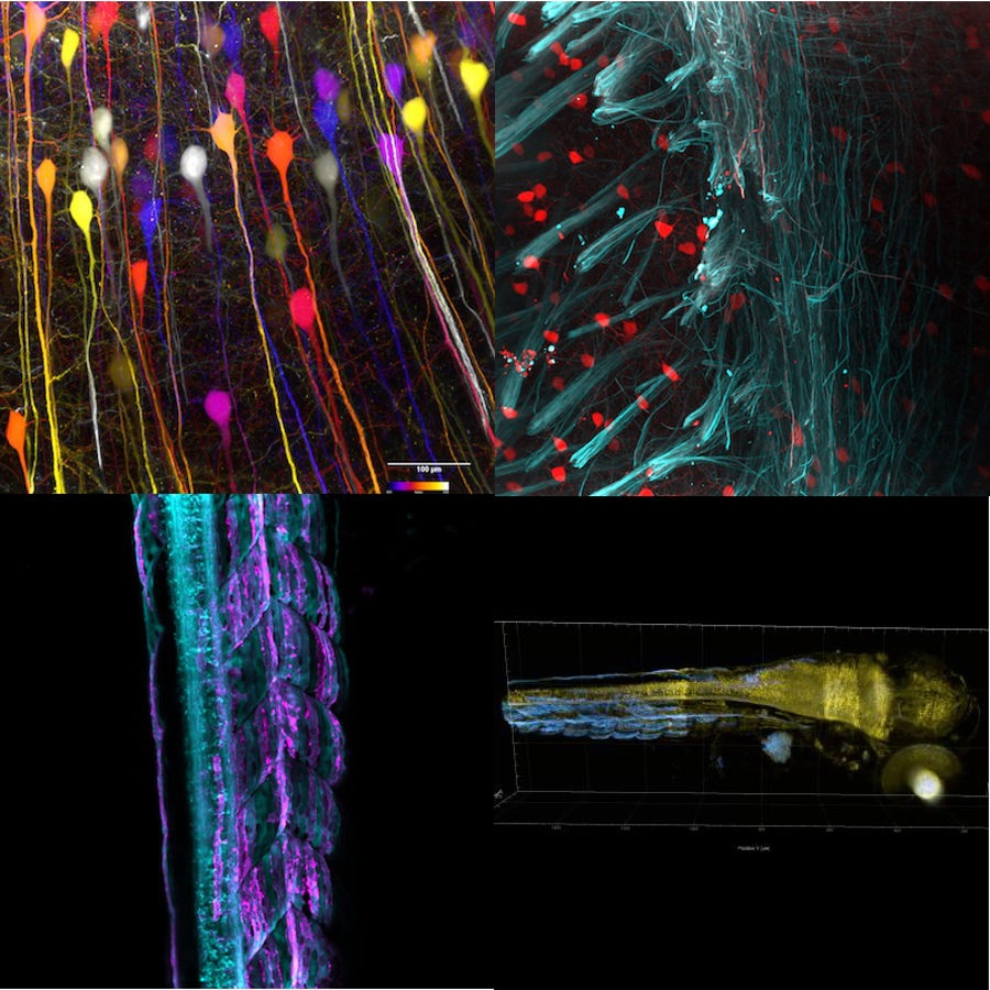 Airy LSM: seeing nerves in action