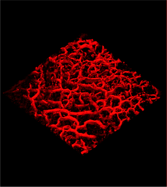 Blood vessel network: key to cancer growth